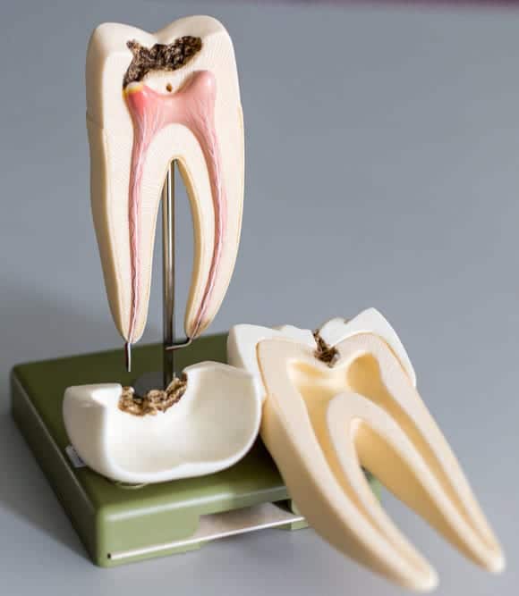 Tulsa Dental Center Tooth