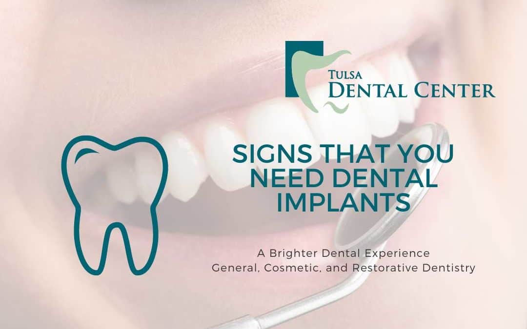 Signs That You Need Dental Implants