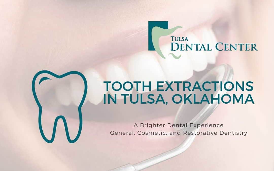 Tooth Extractions in Tulsa, Oklahoma