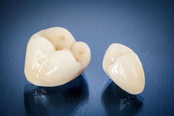 ceramic tooth crown tulsa oklahoma