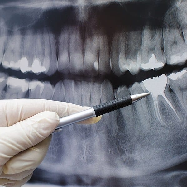dual cone dental ct imaging tulsa ok