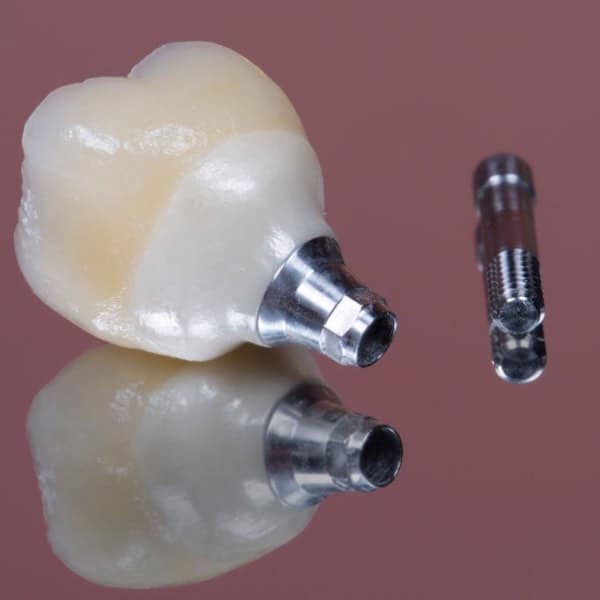 hybrid dental prosthesis tulsa oklahoma