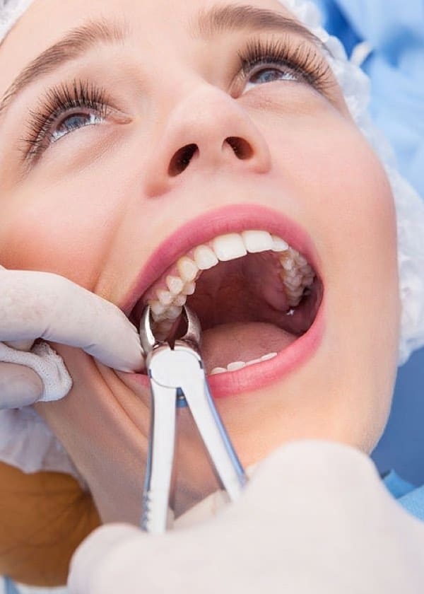 pull tooth extraction tulsa oklahoma