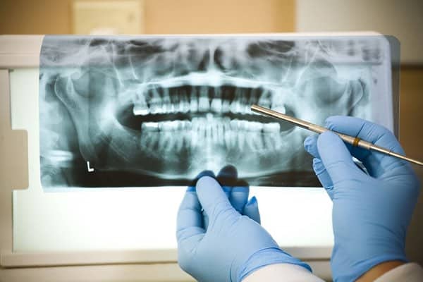 tulsa root canal