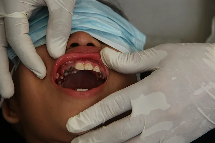 What Constitutes a Dental Emergency? When to Call Your Tulsa Dentist
