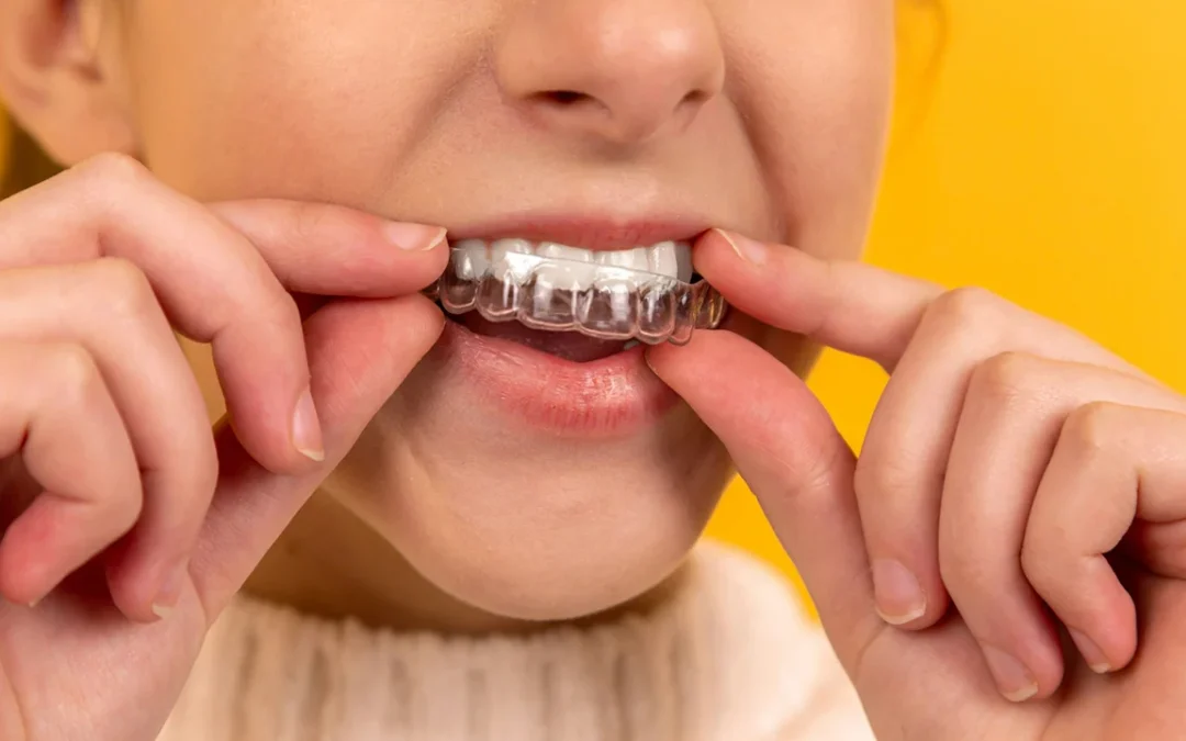 How Much Does Invisalign Cost? Payment Plans and Insurance
