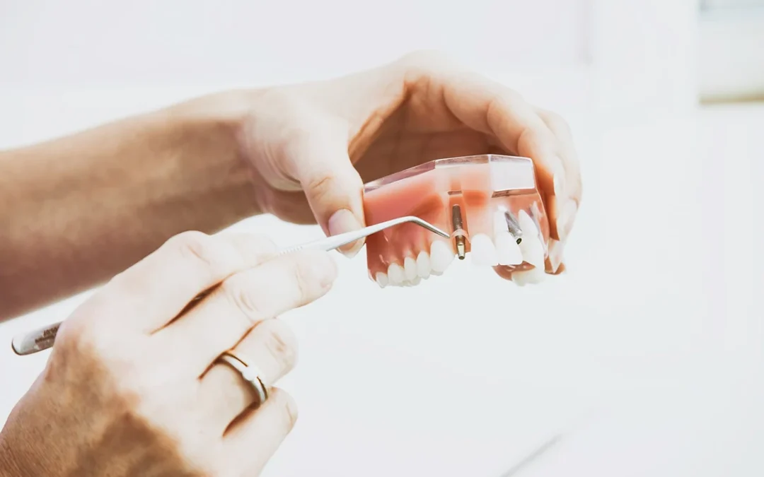 Restorative Dentistry: Everything You Need to Know About Repairing Your Smile